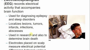 2113 Chapter 12 Central Nervous System Part C