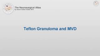 Teflon Granuloma and MVD (Preview)