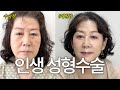 시술로 안 되던 얼굴, 수술로 해결한 후기｜중안면거상+하안검