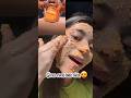 Dark spots 🤯#skincare #daily #homeremedy #aivideo #fair #tan #whiten #skin #glow #best #remove