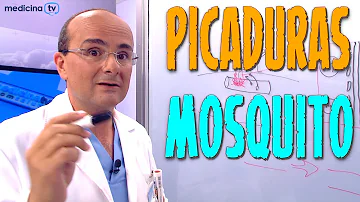 ¿Quién tiene más picaduras de mosquito?