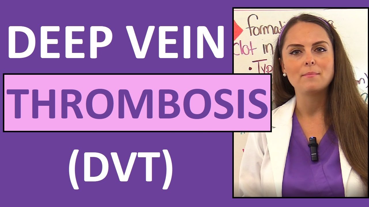 Download Deep Vein Thrombosis (DVT) Nursing | Venous Thromboembolism (VTE) Symptoms, Pathophysiology