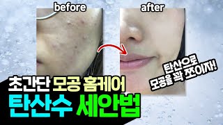 모공 관리에 좋은 탄산수 세안! 가성비 갑 유유유 탄산수제조기로 무제한으로 탄산수 만들자