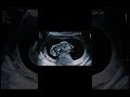 Floating baby in sonography #shortsfeed #baby #babydevelopment #cute