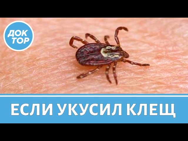 Методы извлечения клеща