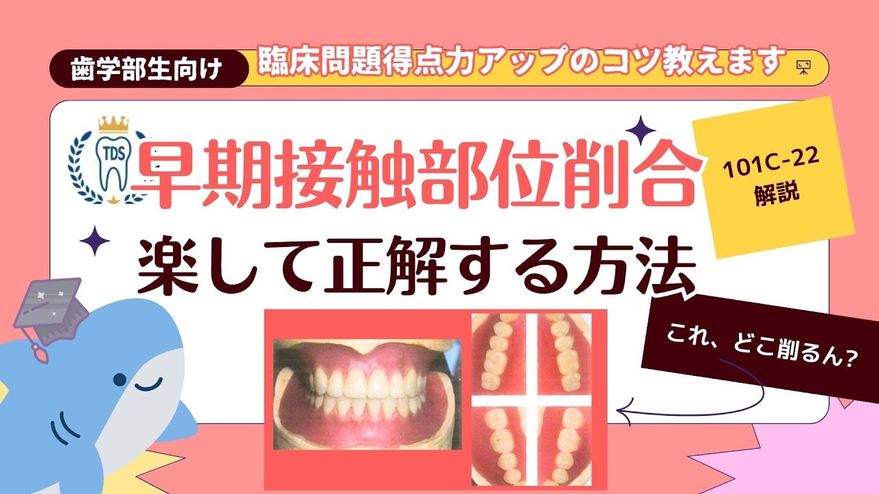 早期接触部位削合 楽して正解する方法 歯科医師国家試験臨床実地対策