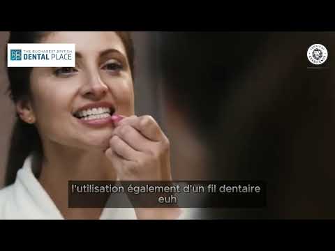 🎥 Comment bien entretenir vos implants dentaires pour qu'ils durent 20 ans (ou plus !) ?