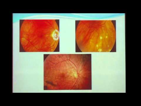 Vídeo: Inflamació Cutània I Ocular Per Trastorn Autoimmune (síndrome Uveodermatològica) En Gossos