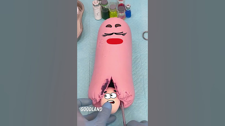 Goodland | What!? They found an egg in the sausage??? 😂 #goodland #Fruitsurgery #doodles #sausage