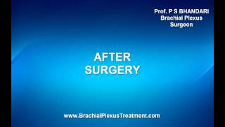 C5,C6 Root Avulsions Treated By Multiple Nerve Transfers