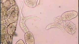 Cercaria Fork-Tailed