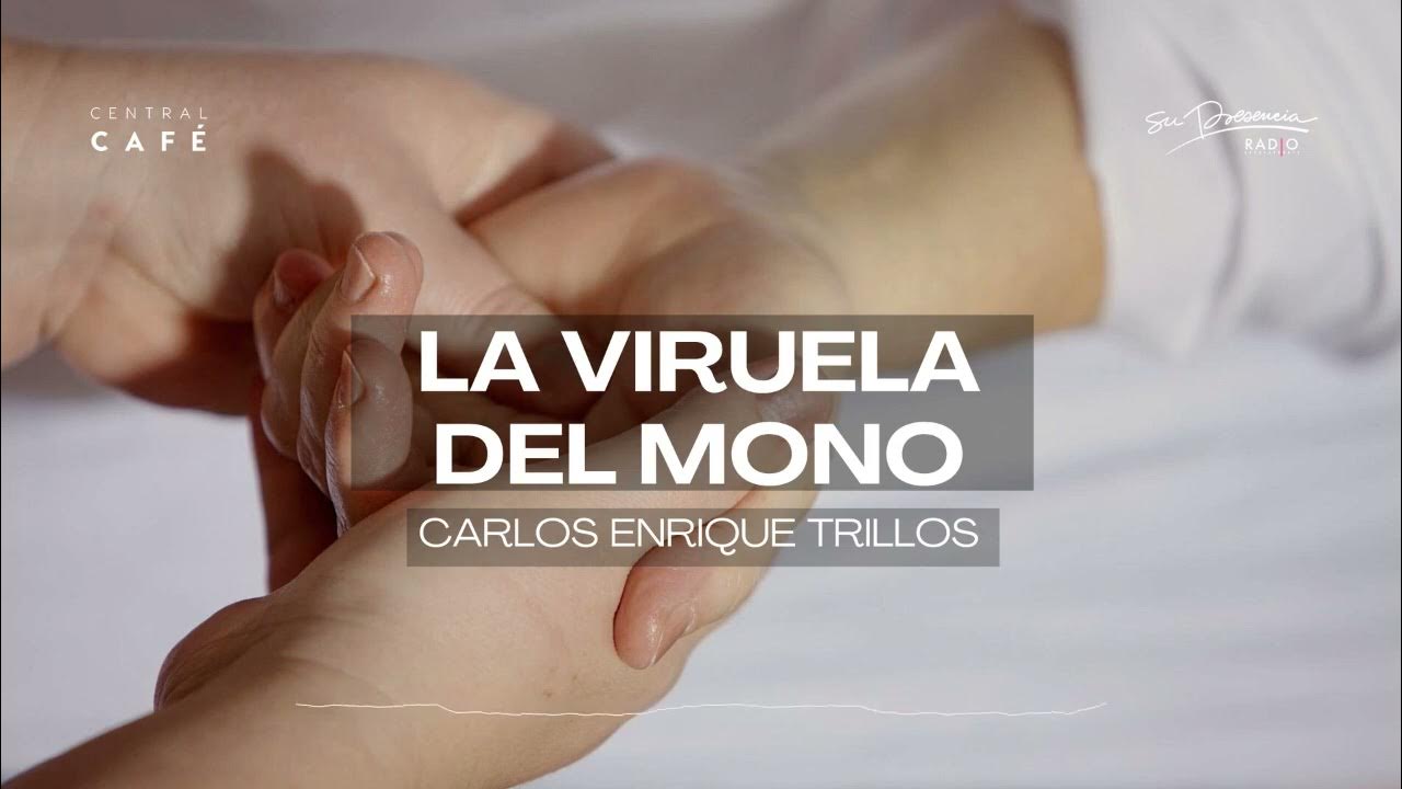 Cuanto tiempo dura la viruela del mono