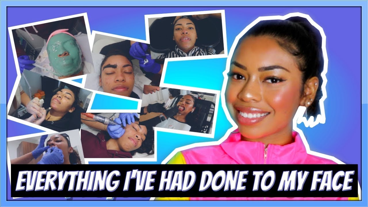 ВСЁ О МОИХ ФИЛЛЕРАХ И ПРЕОБРАЖЕНИЯХ ЛИЦА...