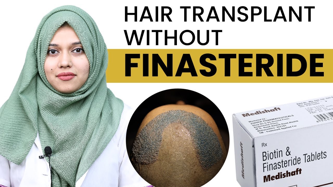 Hair Transplant Without Finasteride Results ? YouTube