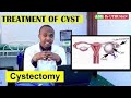 OVARIAN CYSTS, CAUSES, SIGNS, TREATMENT, can i get pregnant,menstruate with a cyst, CAN I CONCEIVE?