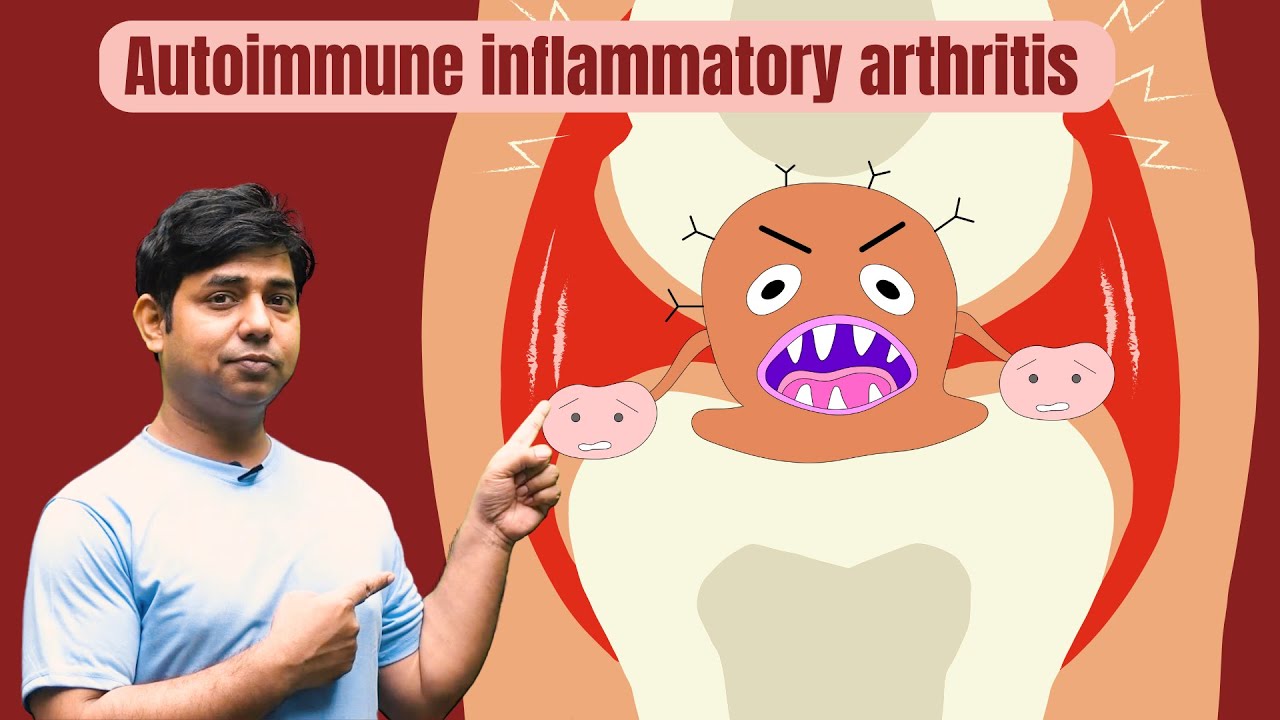Autoimmune inflammatory arthritis YouTube