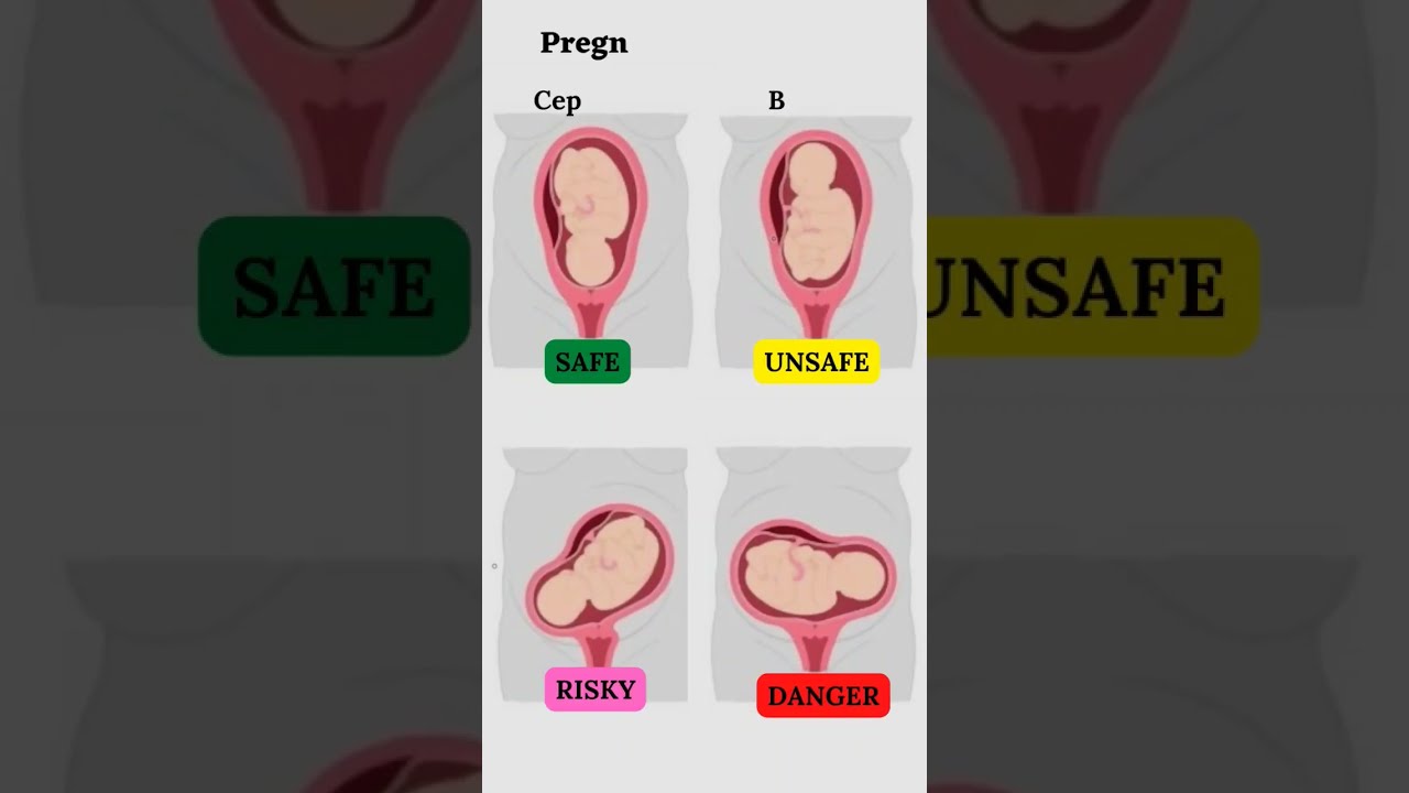 Presentation And Baby S Lie During Pregnancy Shorts