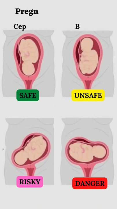 Presentation and Baby's Lie During Pregnancy 👶#shorts