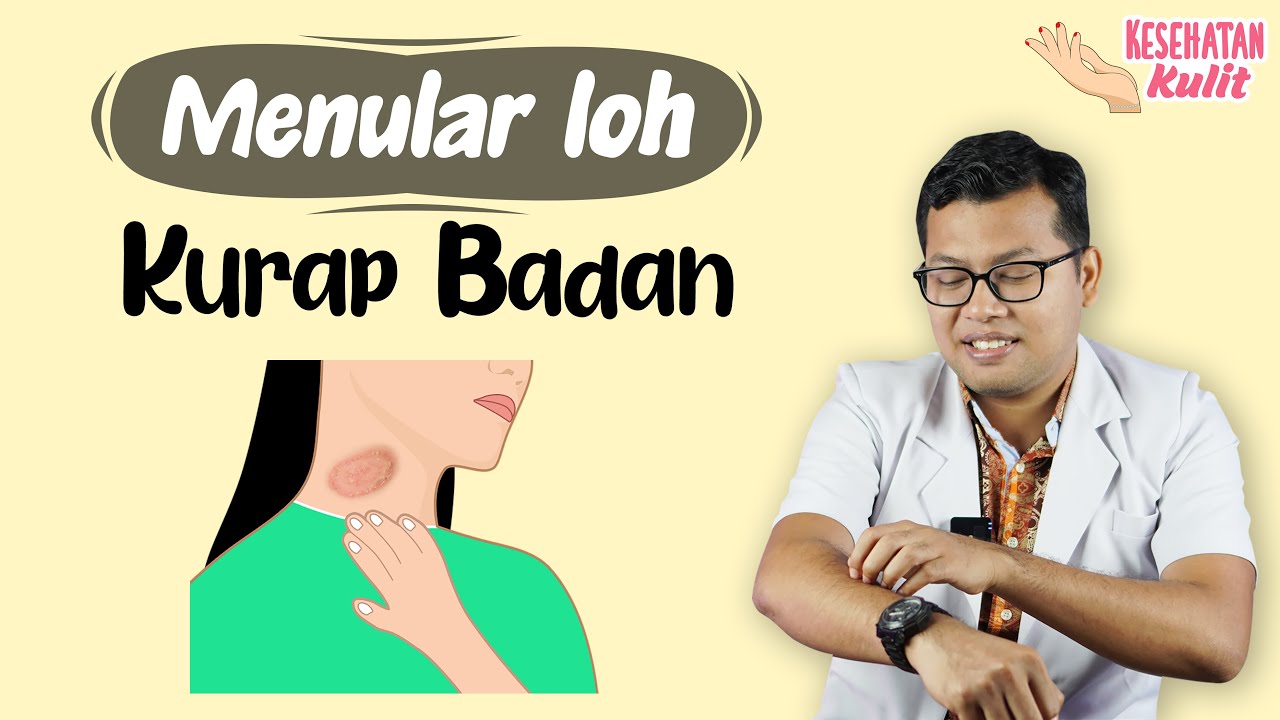 KURAP BADAN ATAU TINEA CORPORIS - DOKTER SADDAM ISMAIL