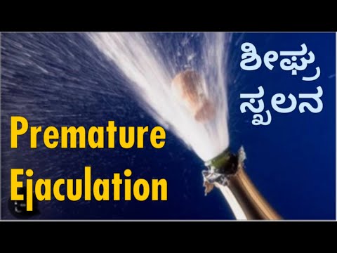 Premature ejaculation, #drcsharathkumar,#sexualhealthtipskannada,#drsharathmensclinic.ಶೀಘ್ರಸ್ಖಲನ,.