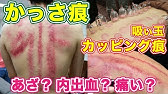 背中とお尻のかっさの方法 かっさプレートの使い方 Youtube 背中とお尻のかっさの方法 かっさプレートの使い方 Youtube