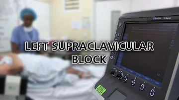 Left Supraclavicular Block - Dr Zahid Sheikh