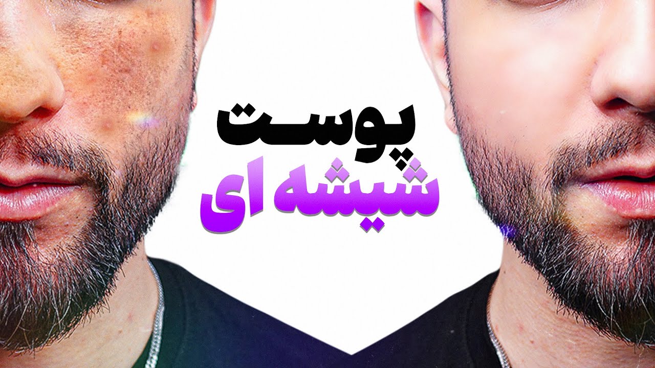 فقط ۱۰ دقیقه وقت بده تا پوستتو نجات بدم! (کاملا واقعی)