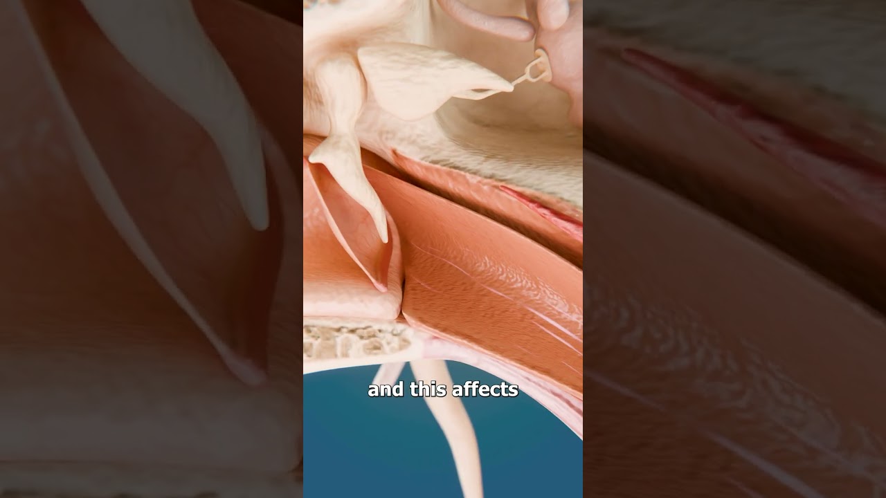 Why Your Ears Pop On A Plane π€