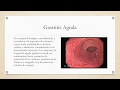 Farmacia. Fisiopatología. Gastritis