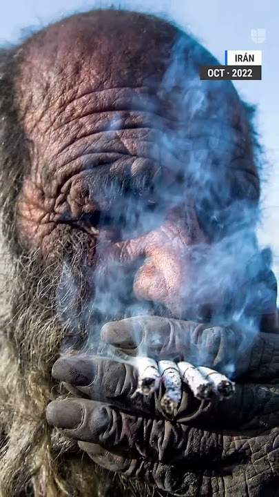 Muere ‘el hombre más sucio del mundo’ meses después de que lo bañaran