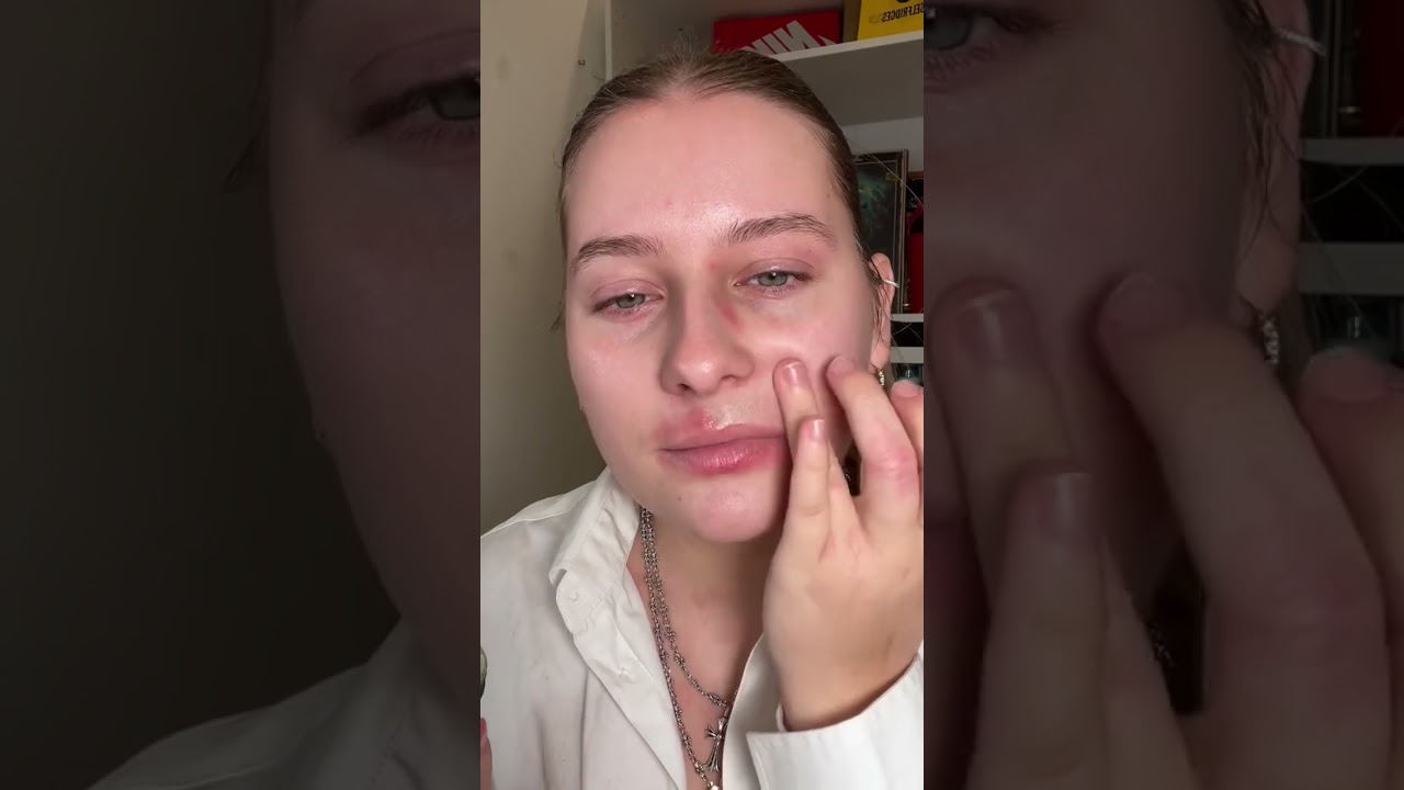 game changing product for eczema π€