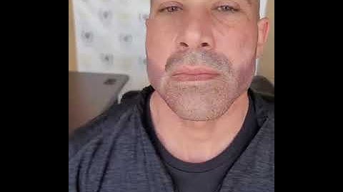 Scalp Micropigmentation Beard