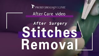 stitches Removal after surgery