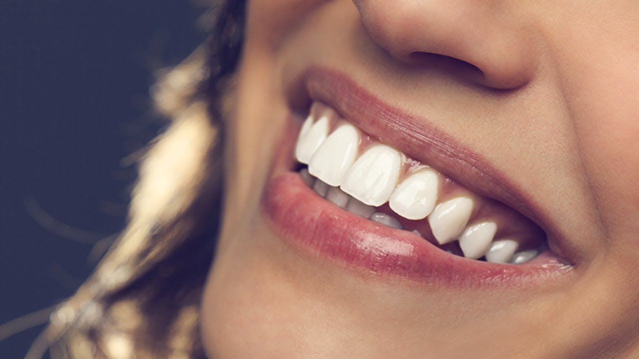 Qual O Valor De Uma Prótese De Acrílico?