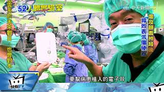 20170901中天新聞　人體實驗室　安裝人工耳蝸　聽障者走出寂靜世界