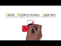 Familial chylomicronemia syndrome fcs