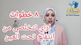 ازاي تتخلصي من انتفاخ تحت العين في ٨ خطوات || حبة صيدلة