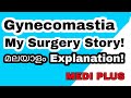 What is the solution for Gynecomastia in malayalam |Gynecomastia reduction surgery