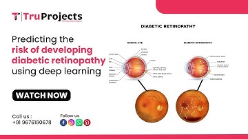 Predicting the risk of developing diabetic retinopathy using deep learning MAJOR PROJECTS PROVIDERS