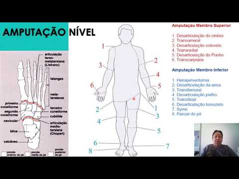 Vídeo: O que são próteses passivas?