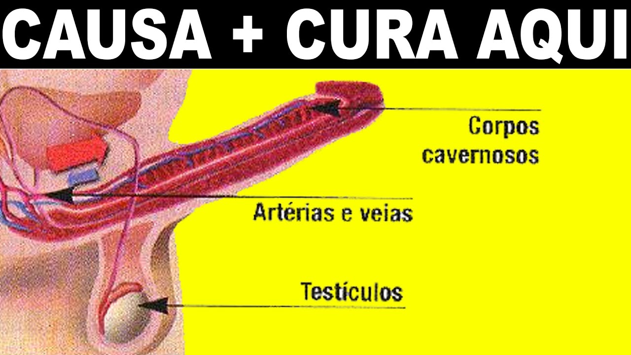 Causas por las que puede doler un testiculo