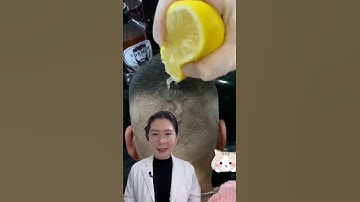 Trị gàu bằng Chanh và baking soda #thsbsphuongquy #lamdep #shorts #fyp