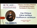 Valve aortique insuffisance cardiaque  eric abergel