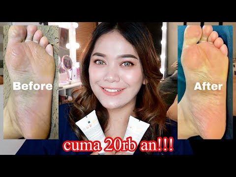 Video: Prosedur Kosmetik Untuk Kaki