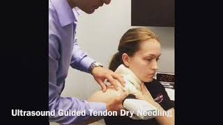 Ultrasound Guided Dry Needling led by Raphael Soares