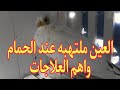 العين ملتهبه عند الحمام واهم العلاجات ياسر ادهم حمام النش