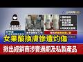 女果酸換膚慘遭灼傷 揪出經銷商涉賣過期及私製產品
