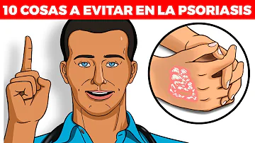 ¿Es bueno el marisco para la psoriasis?