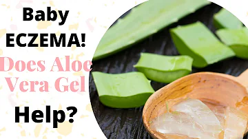 ¿Es bueno el aloe vera para el eczema?