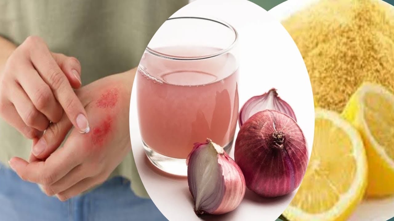 Kitchen Burn Scar Secrets: DIY Healing & Fading Packs! ?